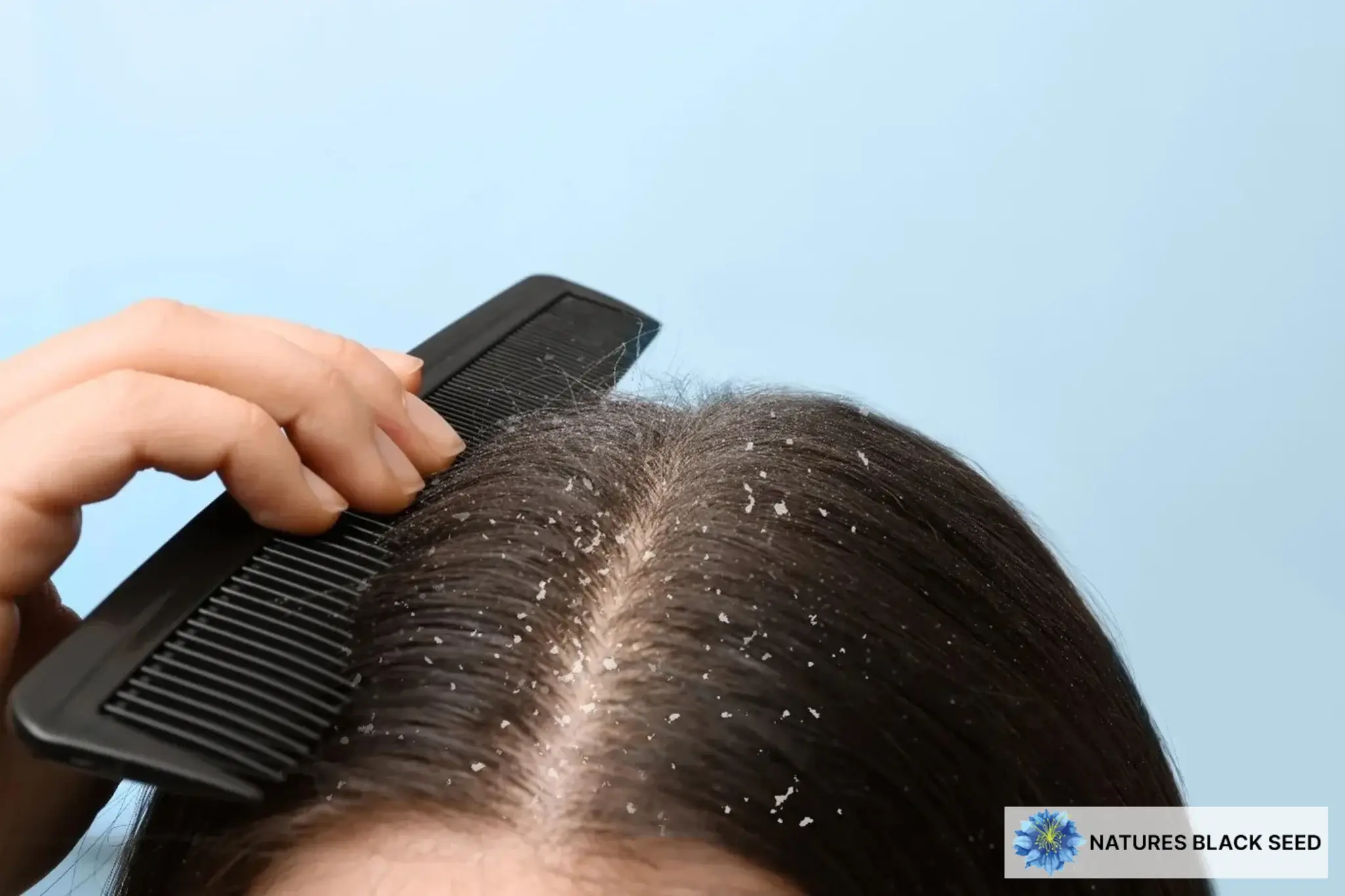 black seed oil for hair dandruff