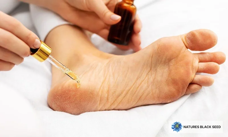 black seed oil for foot fungus