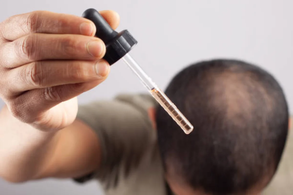 black seed oil for alopecia areata